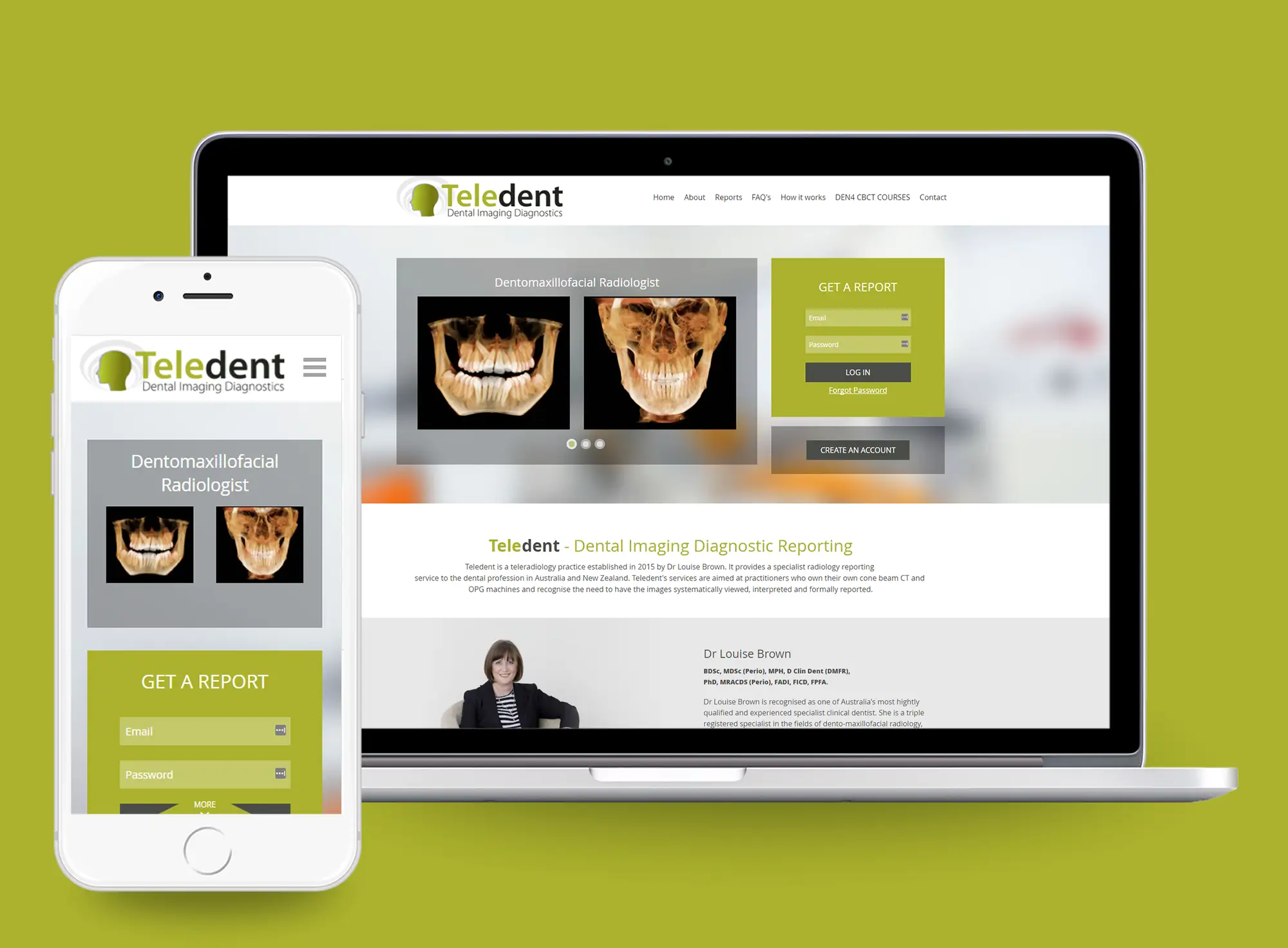 Teledent laptop
