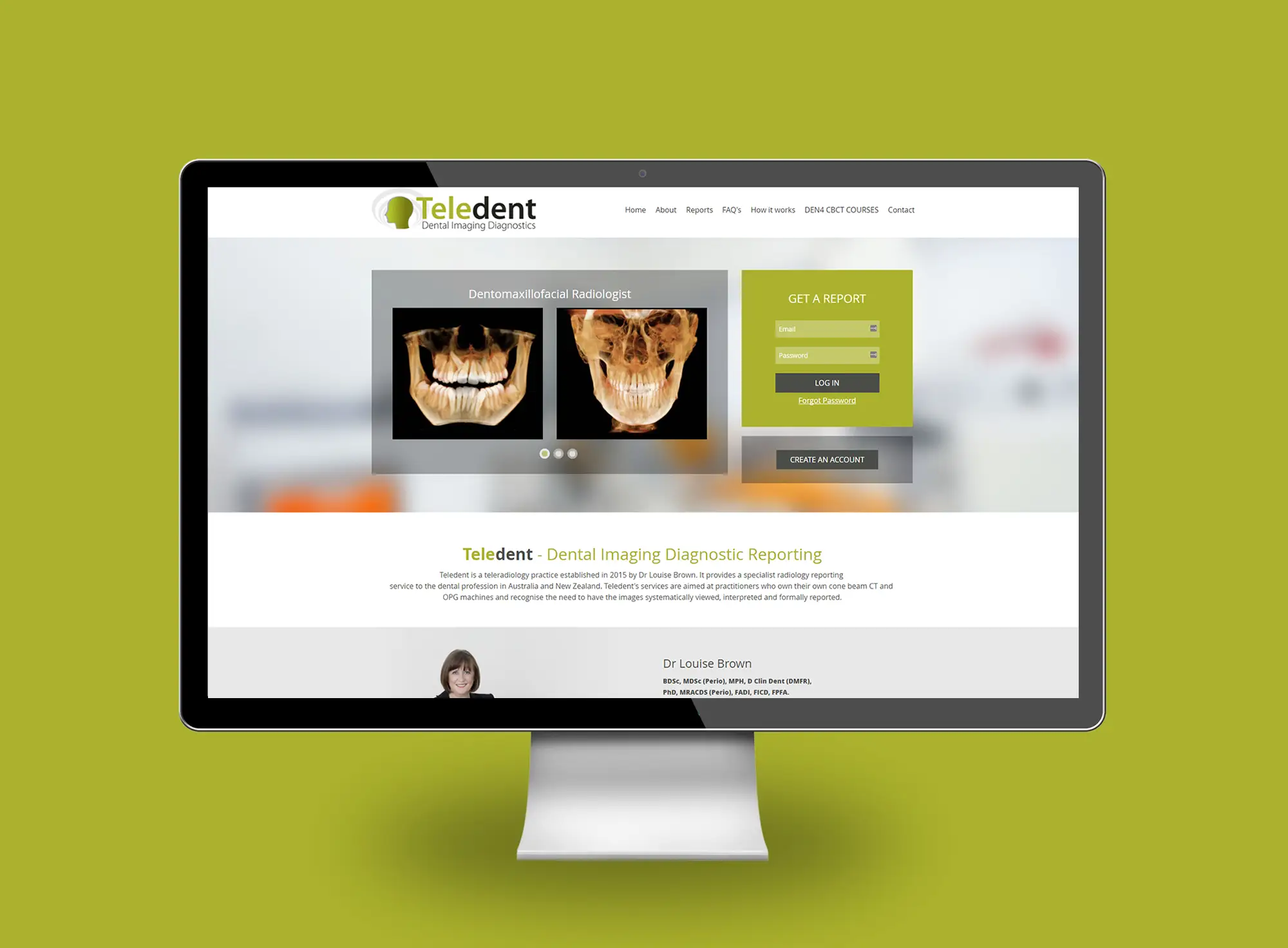 Teledent desktop